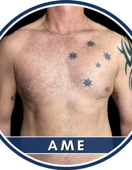 Aussie Men Exhibit | FREE ๐ฆ๐บ profile photo