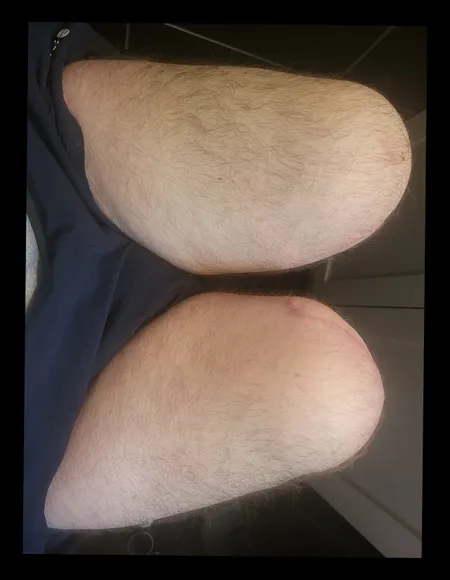 Bilateral Bo profile photo