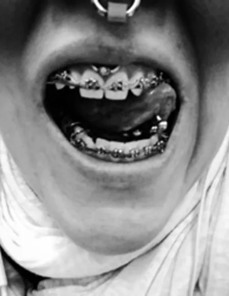 Teethshow profile photo