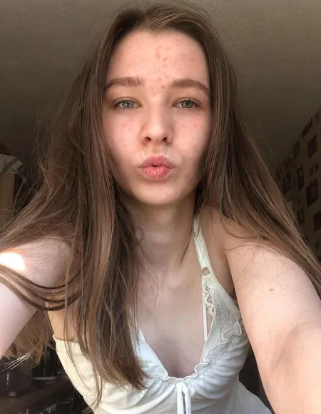 Emmi-Hill profile photo