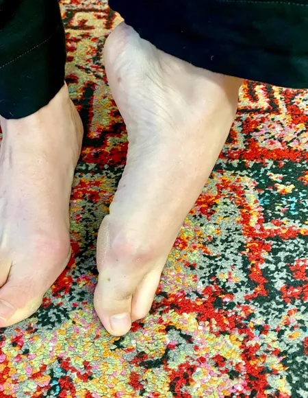 Hallux Valgus Vixen profile photo